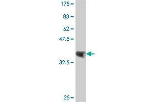 Western Blot detection against Immunogen (37 KDa) . (CSRP1 antibody  (AA 94-192))