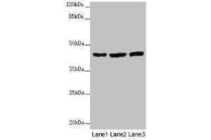 Western blot All lanes: MTERF4 antibody at 2 μg/mL Lane 1: Mouse kidney tissue Lane 2: HL60 whole cell lysate Lane 3: A549 whole cell lysate Secondary Goat polyclonal to rabbit IgG at 1/10000 dilution Predicted band size: 44 kDa Observed band size: 44 kDa (MTERFD2 antibody  (AA 45-87))