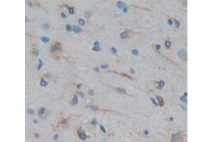 Figure. (CCDC3 antibody  (AA 22-251))