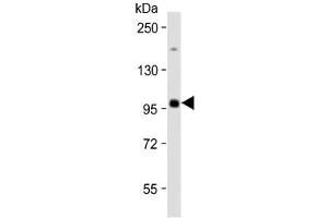 Western blot testing of human Raji cell lysate with MAP4K1 antibody at 1:2000.