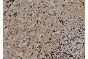 ABIN6257460 and ABIN6273388 at 1/100 staining Human liver tissue by IHC-P.
