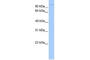 NUP98 antibody used at 1 ug/ml to detect target protein.