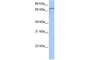 Transglutaminase 7 antibody used at 1 ug/ml to detect target protein. (Transglutaminase 7 antibody  (C-Term))
