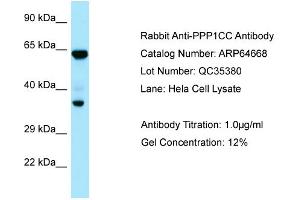 Western Blotting (WB) image for anti-Protein Phosphatase 1, Catalytic Subunit, gamma Isoform (PPP1CC) (C-Term) antibody (ABIN2789917) (PPP1CC antibody  (C-Term))