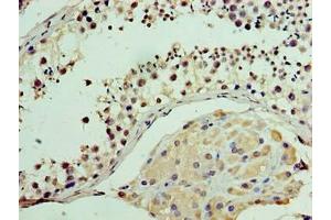 Immunohistochemistry of paraffin-embedded human testis tissue using ABIN7175278 at dilution of 1:100 (MON1A antibody  (AA 205-555))