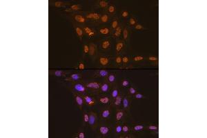 Immunofluorescence analysis of C6 cells using CDC16 Rabbit mAb (ABIN1678585, ABIN3017837, ABIN3017838 and ABIN7101525) at dilution of 1:100 (40x lens). (CDC16 antibody)