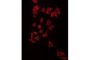 ABIN6272334 staining RAW264. (KCNJ3 antibody  (Internal Region))