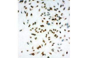 Anti-MCM6 antibody, ICC ICC: HELA Cell (MCM6 antibody  (Middle Region))