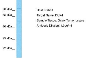 Host: Rabbit Target Name: DUX4 Sample Type: Ovary tumor lysates Antibody Dilution: 1. (DUX4 antibody  (N-Term))