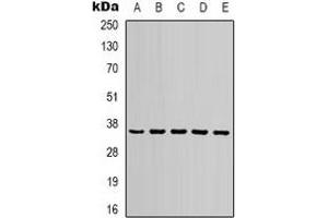 Western blot analysis of GAPDH expression in 293T (A), NIH3T3 (B), rat brain (C), sheep muscle (D), rabbit testis  (E) whole cell lysates. (GAPDH antibody)