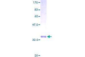 Deleted in Lymphocytic Leukemia 1 (Non-Protein Coding) (DLEU1) (AA 1-78) protein (GST tag)