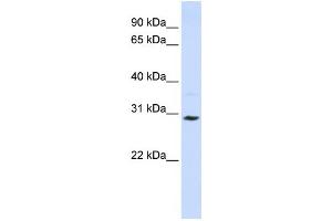 Western Blotting (WB) image for anti-Solute Carrier Family 25 (Carnitine/acylcarnitine Translocase), Member 20 (SLC25A20) antibody (ABIN2458773) (SLC25A20 antibody)