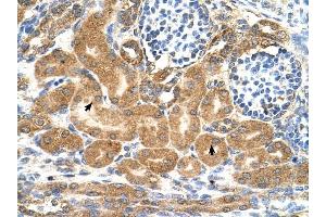 TMEM69 antibody was used for immunohistochemistry at a concentration of 4-8 ug/ml to stain EpitheliaI cells of renal tubule (arrows) in Human Kidney. (TMEM69 antibody  (Middle Region))