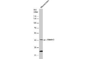 WB Image Ataxin 3 antibody detects Ataxin 3 protein by western blot analysis.