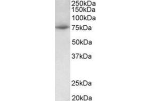 Western Blotting (WB) image for anti-Protein Arginine Methyltransferase 7 (PRMT7) (Internal Region) antibody (ABIN1108738)
