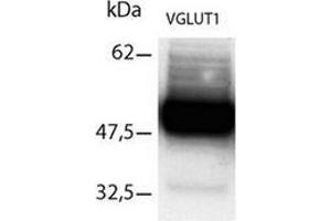 Western Blotting (WB) image for anti-Solute Carrier Family 17 (Vesicular Glutamate Transporter), Member 7 (SLC17A7) (C-Term) antibody (ABIN1109031)