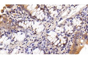 Immunohistochemistry (IHC) image for anti-High Mobility Group Box 1 (HMGB1) (AA 1-215) antibody (ABIN7431746)
