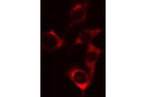 ABIN6274720 staining Hela cells by IF/ICC. (MRPS18C antibody  (Internal Region))