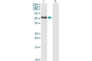 Western Blot analysis of AGT expression in transfected 293T cell line by AGT monoclonal antibody (M04), clone 3C10. (AGT antibody  (AA 1-485))