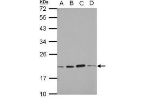WB Image Sample (30 ug of whole cell lysate) A: A549 B: H1299 C: HCT116 D: MCF-7 12% SDS PAGE antibody diluted at 1:1000 (SKP1 antibody)