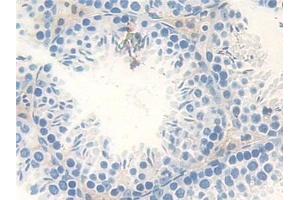 Detection of Smad4 in Mouse Testis Tissue using Polyclonal Antibody to Mothers Against Decapentaplegic Homolog 4 (Smad4) (SMAD4 antibody  (AA 9-231))