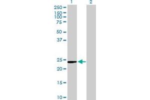 Western Blot analysis of C9orf95 expression in transfected 293T cell line by C9orf95 MaxPab polyclonal antibody. (NMRK1 antibody  (AA 1-199))