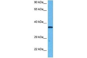 Host:  Rabbit  Target Name:  E2F5  Sample Tissue:  Human Jurkat Whole Cell  Antibody Dilution:  1ug/ml (E2F5 antibody  (N-Term))