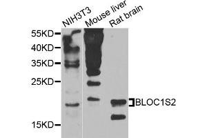 Western blot analysis of extracts of various cell lines, using BLOC1S2 antibody (ABIN5975690) at 1/1000 dilution.