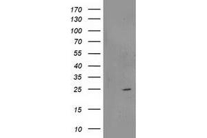 HEK293T cells were transfected with the pCMV6-ENTRY control (Left lane) or pCMV6-ENTRY RGS5 (Right lane) cDNA for 48 hrs and lysed. (RGS5 antibody)