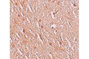 Immunohistochemical staining of human brain cells with LMBRD1 polyclonal antibody  at 2. (LMBRD1 antibody  (C-Term))
