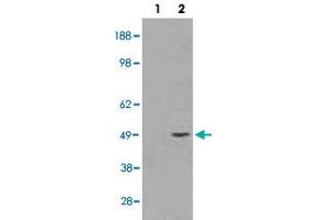 HEK293 overexpressing STRADB and probed with STRADB polyclonal antibody  (mock transfection in first lane), tested by Origene.