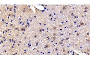 Detection of FADD in Mouse Cerebrum Tissue using Polyclonal Antibody to Fas Associating Death Domain Containing Protein (FADD) (FADD antibody  (AA 7-178))