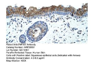 Human Skin (ZNF397 antibody  (C-Term))