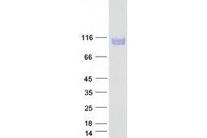 Western Blotting (WB) image for Sema Domain, Immunoglobulin Domain (Ig), Transmembrane Domain (TM) and Short Cytoplasmic Domain, (Semaphorin) 4B (SEMA4B) (Transcript Variant 2) protein (Myc-DYKDDDDK Tag) (ABIN2731620)