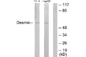 Immunohistochemistry analysis of paraffin-embedded human colon carcinoma tissue using Desmin (Ab-60) antibody. (Desmin antibody)