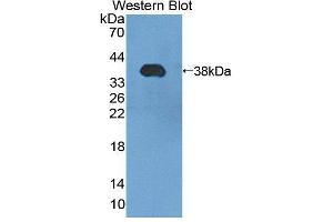 Western blot analysis of the recombinant protein. (PMM1 antibody  (AA 2-262))