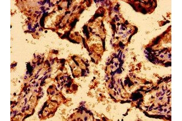 Sacsin antibody  (AA 983-1150)