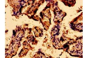 Immunohistochemistry of paraffin-embedded human placenta tissue using ABIN7168566 at dilution of 1:100