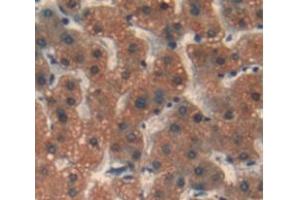 IHC-P analysis of Human Tissue, with DAB staining. (REV1 antibody  (AA 472-652))