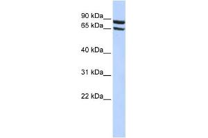WB Suggested Anti-SLC6A15 Antibody Titration:  0.