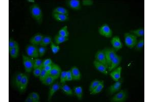 Immunofluorescence staining of HepG2 cells with ABIN7150084 at 1:166, counter-stained with DAPI. (DLGAP2 antibody  (AA 31-139))