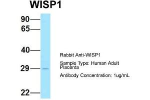 Host: Rabbit  Target Name: WISP1  Sample Tissue: Human Adult Placenta  Antibody Dilution: 1. (WISP1 antibody  (Middle Region))