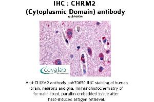 Image no. 1 for anti-Cholinergic Receptor, Muscarinic 2 (CHRM2) (3rd Cytoplasmic Domain) antibody (ABIN1733054) (Muscarinic Acetylcholine Receptor M2 antibody  (3rd Cytoplasmic Domain))