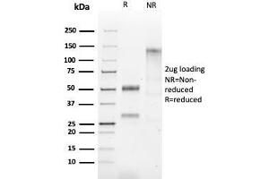 SDS-PAGE Analysis of Purified HSP60 Rabbit Recombinant Monoclonal Antibody (HSPD1/2206R). (Recombinant HSPD1 antibody)