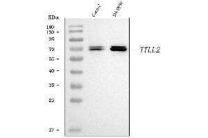 Western blot analysis of TTLL2 using anti-TTLL2 antibody (ABIN7600850). (TTLL2 antibody  (AA 24-582))