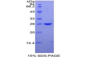 SDS-PAGE analysis of Mouse DIXDC1 Protein.