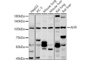 Western blot analysis of extracts of various cell lines, using AHR antibody (ABIN3015499, ABIN3015500, ABIN5663909 and ABIN6218543) at 1:1000 dilution. (Aryl Hydrocarbon Receptor antibody  (AA 619-848))