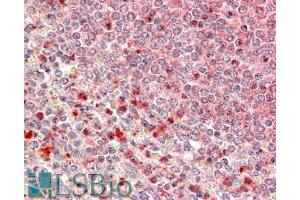 ABIN570777 (5µg/ml) staining of paraffin embedded Human Spleen. (UBR4 antibody  (C-Term))