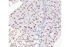 Immunohistochemistry (Paraffin-embedded Sections) (IHC (p)) image for anti-Polyglutamine Binding Protein 1 (PQBP1) antibody (ABIN7075126)