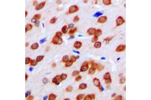 Immunohistochemical analysis of FPR1 staining in human brain formalin fixed paraffin embedded tissue section. (FPR1 antibody  (Center))